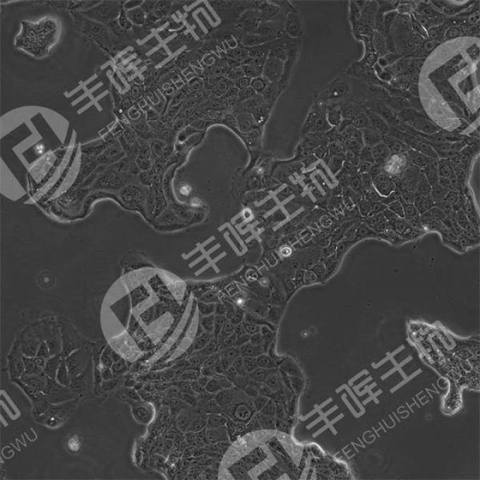 CALU-3细胞（人肺腺癌细胞）