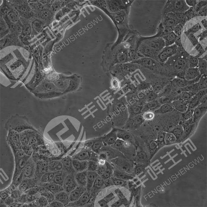 CALU-3细胞（人肺腺癌细胞）