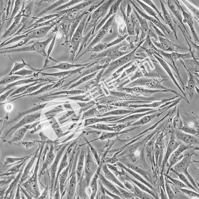 Bend.3细胞（小鼠脑微血管内皮细胞）