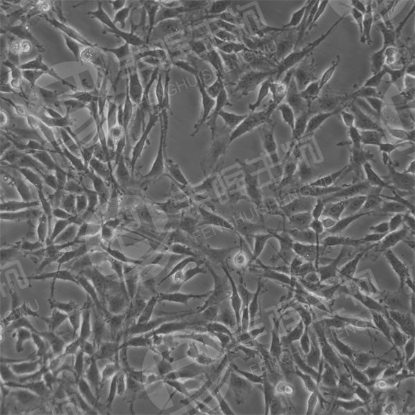 B104细胞（大鼠神经胶质瘤细胞）