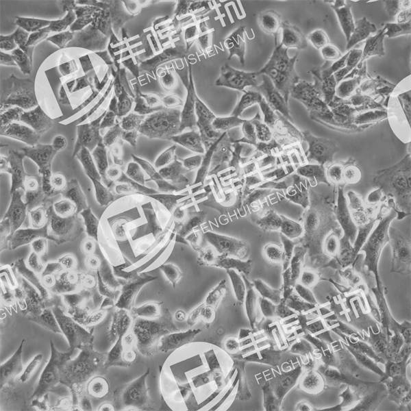 SCC-7细胞（小鼠鳞状癌细胞）