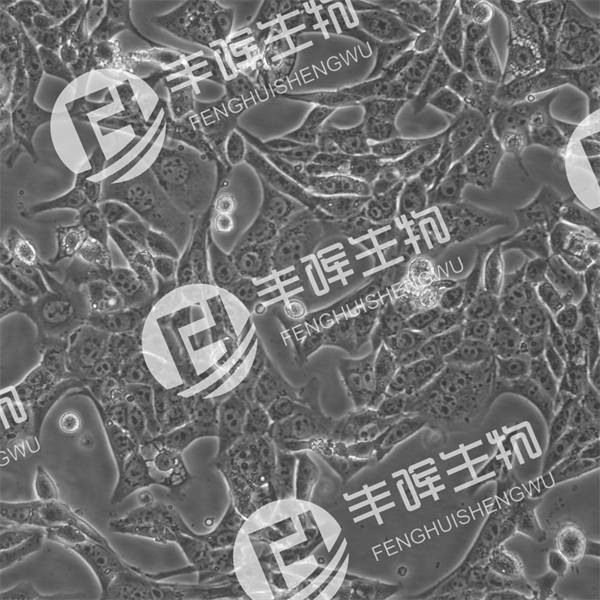 RENCA细胞（小鼠肾癌细胞）