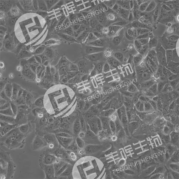 MCF7细胞（人乳腺癌细胞）